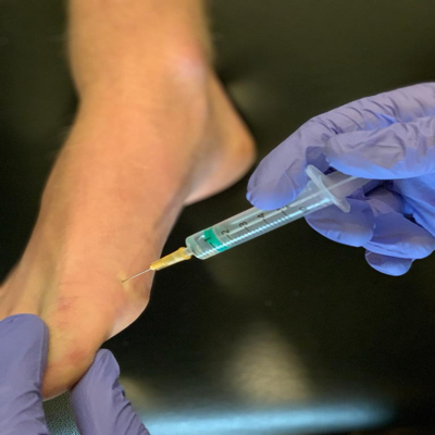 foot resized injection jpg
